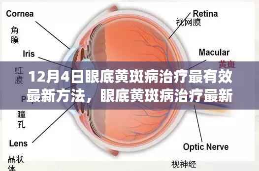 眼底黄斑病治疗最新方法深度探讨与观点阐述,有效治疗策略分析