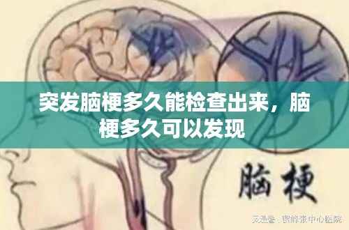突发脑梗多久能检查出来,脑梗多久可以发现